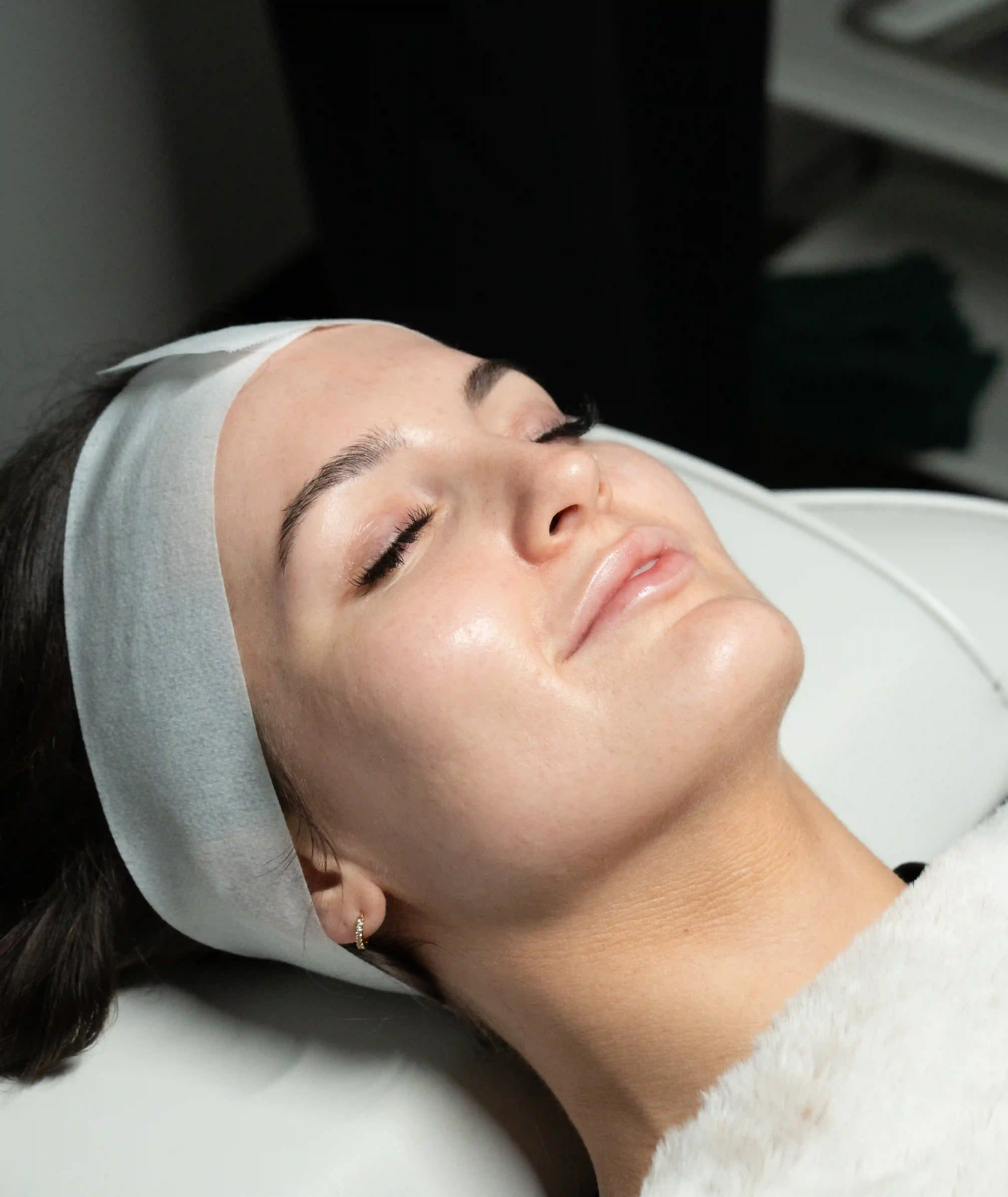 Sculptra treatment at Revitalise Aesthetics Liverpool